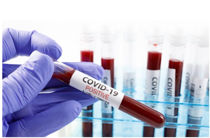 covid19_rapid_kit